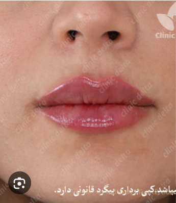 بعد